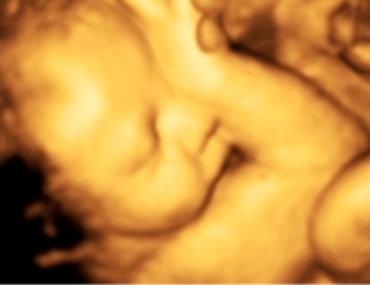 Saptamana 38 de sarcina