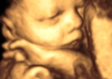 Saptamana 39 de sarcina