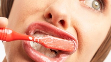 Umflarea si sangerarea gingiilor