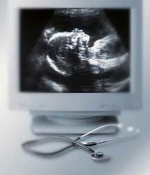 Diagnosticarea bolilor genetice in timpul graviditatii