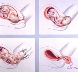 Perioada a doua a nasterii