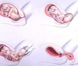 Perioada a treia a nasterii
