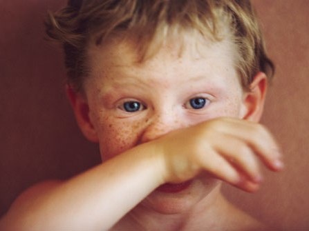 Scarlatina La Copii Simptome Si Tratament