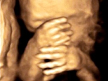 Marea istorie a sarcinii, in ecografii (Galerie foto)