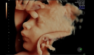 Zambetele si miscarile viitorului bebelus in 4D