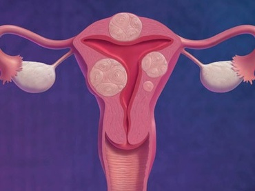 Sase cauze ale durerilor pelvine