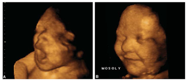 Etapele dezvoltarii fatului pe saptamani