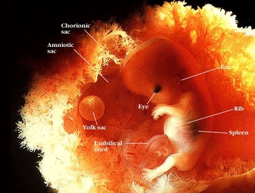Excesul de lichid amniotic