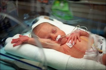 Nasterea unui prematur