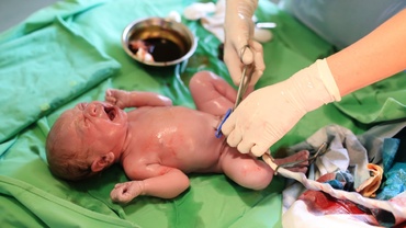 Taierea cu intarziere a cordonului ombilical, benefica copilului