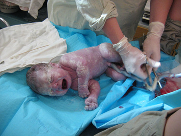 Da, poti pati asa ceva la nastere