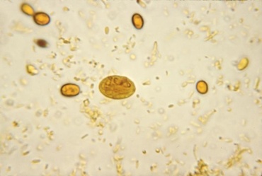 Giardia (giardioza)