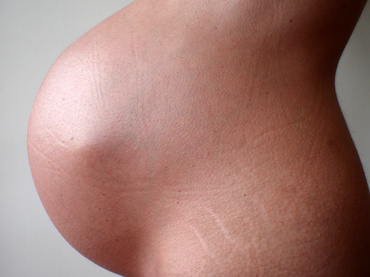 Aspectul abdomenului