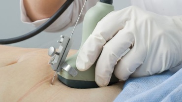 Cum se simte amniocenteza