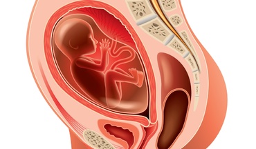 Uterul retrovers si sarcina