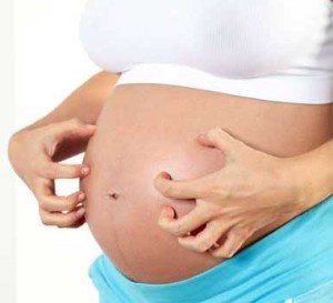 Cauze si solutii pentru mancarimile din timpul sarcinii (I)