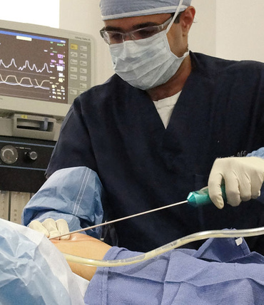 Liposuctie dupa nastere