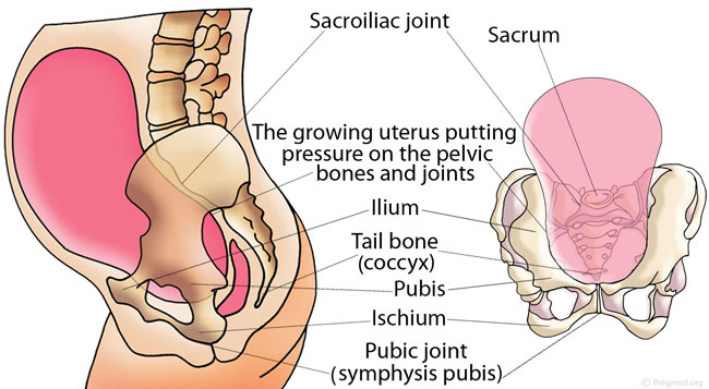 varicoza în timpul sarcinii pelvis