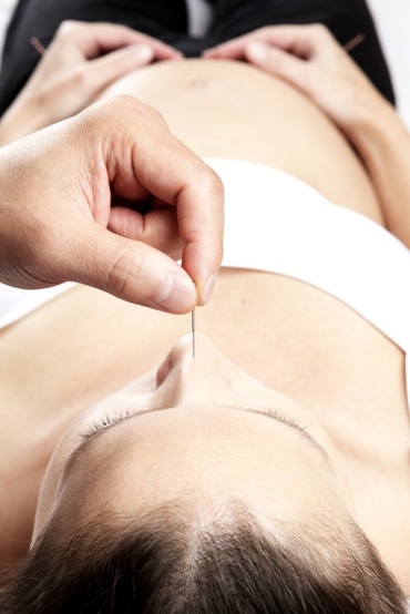 Acupunctura in sarcina