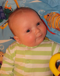 Torticolisul nou nascutilor