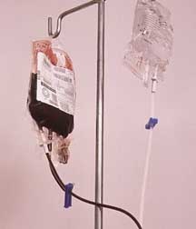 RH negativ sau pozitiv