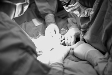 Cezariana in imagini