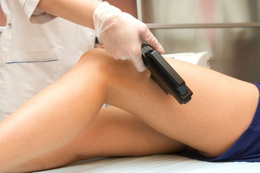 Epilarea definitiva in sarcina