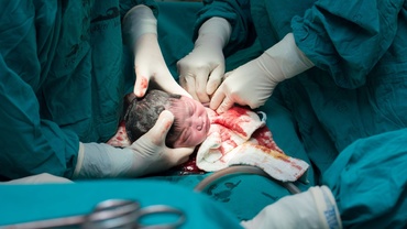 10 întrebări privind operația de cezariană