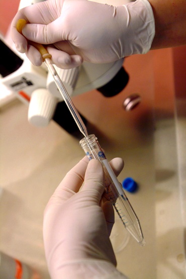 Inseminarea artificiala (IUI)