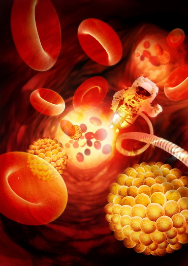 Hemocultura - analiza de sange la copii