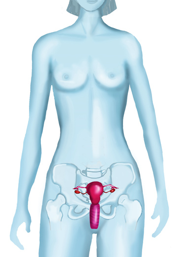 Sindromul ovarelor polichistice si sarcina