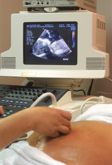 Insuficienta de col uterin