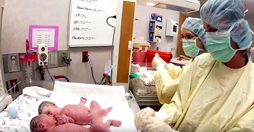 Video: nastere de gemeni prin cezariana