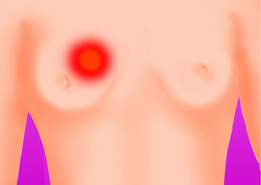 La ce fel de doctor te duci pentru examinarea sanilor?