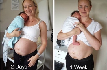 Etapele transformarii corpului dupa nastere