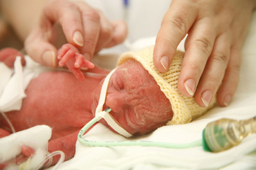 Nasterea unui prematur este tot un motiv de bucurie