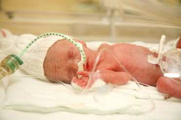 Problemele respiratorii ale prematurilor