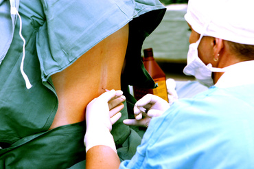 Distocia de umar (umerala)