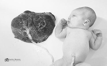 Nasterea Lotus: beneficiile din spatele unui trend