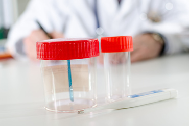 Infecţia urinară în sarcină. Simptome şi tratament