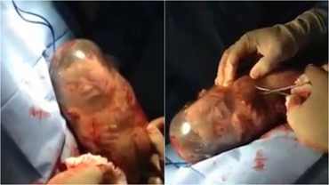 Video-ul care a făcut înconjurul lumii: Momentul în care un bebeluș iese din sacul amniotic
