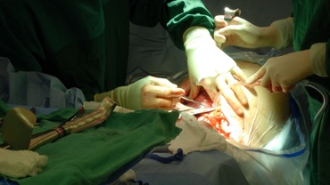 Cum am ajuns la cezariană, deşi voiam să nasc natural