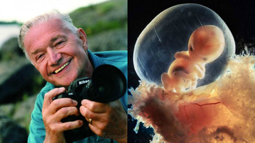 Cum se formează un pui de om. Proiectul fotografic care a durat 10 ani