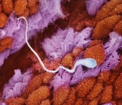 Spermatozoid mișcându-se spre ovul