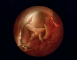 36 săptămâni. Peste o lună, copilul se va naște