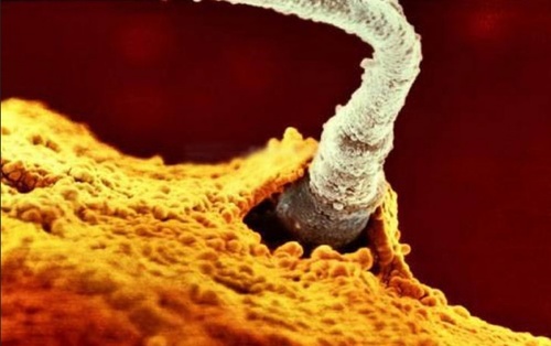 Unul dintre 200 de milioane de spermatozoizi sparge membrana ovulului