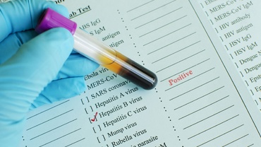 Virusul hepatitei B în timpul sarcinii