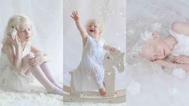 Frumusețe în nuanțe de alb! 10 fotografii angelice cu persoane care suferă de albinism