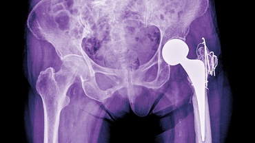 Chirurgul ortoped Gheorghe Burnei, audiat pentru experimente neautorizate pe copii